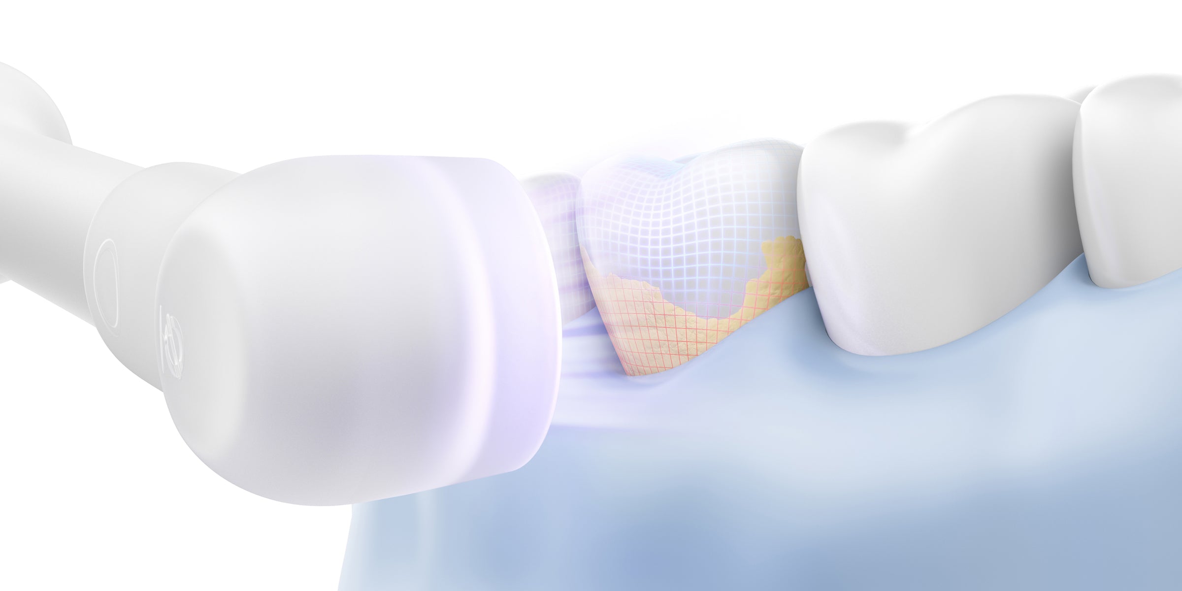 Cameră AI pentru detectarea plăcii dentare - 